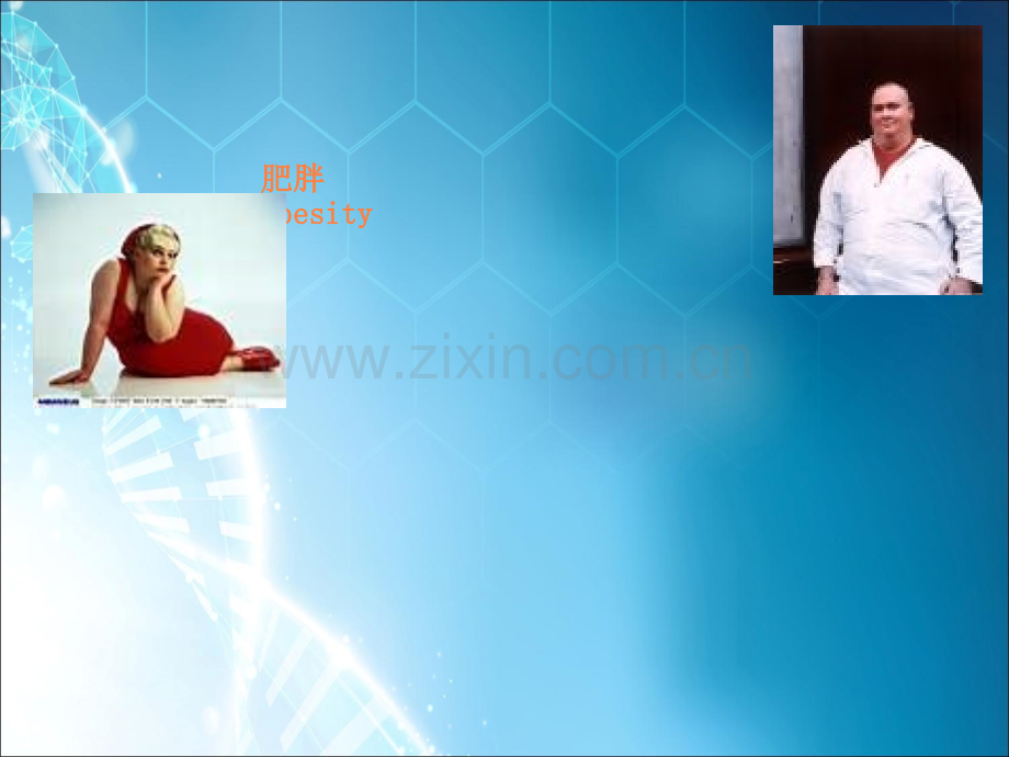 肥胖发病机制ppt课件.ppt_第1页