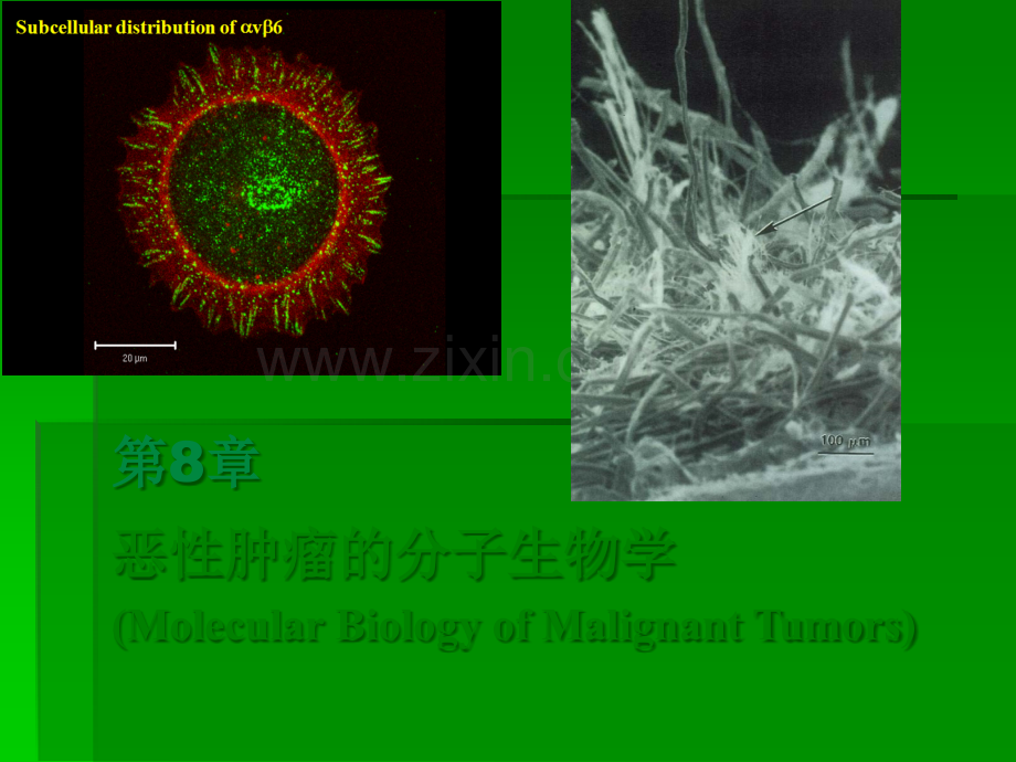 恶性肿瘤的分子生物学分解ppt课件.ppt_第1页