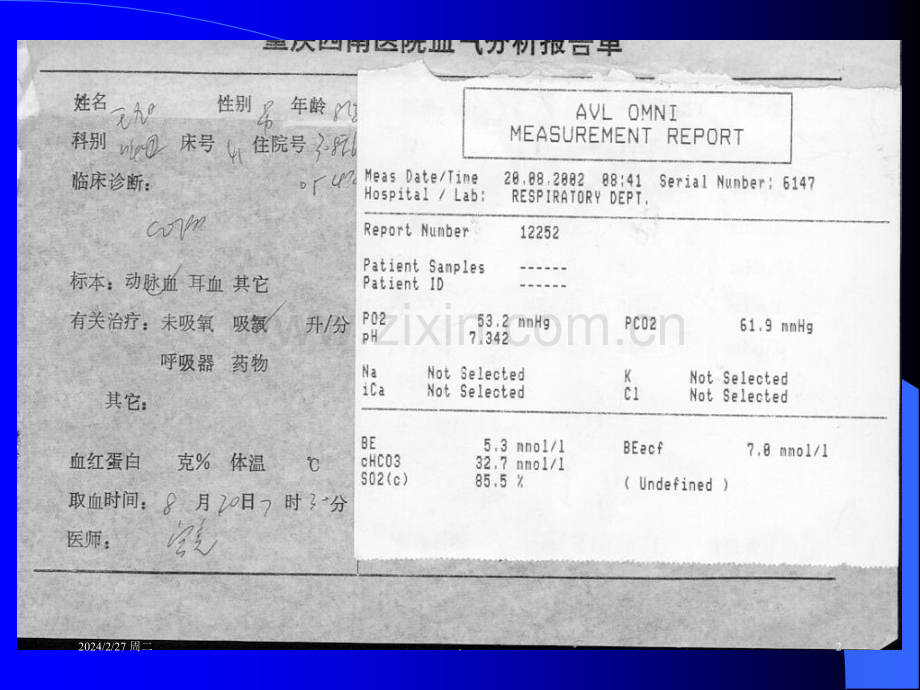 动脉血气分析及酸碱失衡的判断ppt课件.ppt_第2页