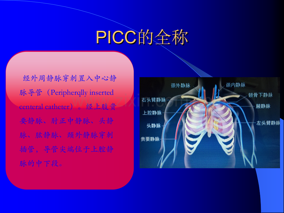 picc置管护理ppt课件.ppt_第2页
