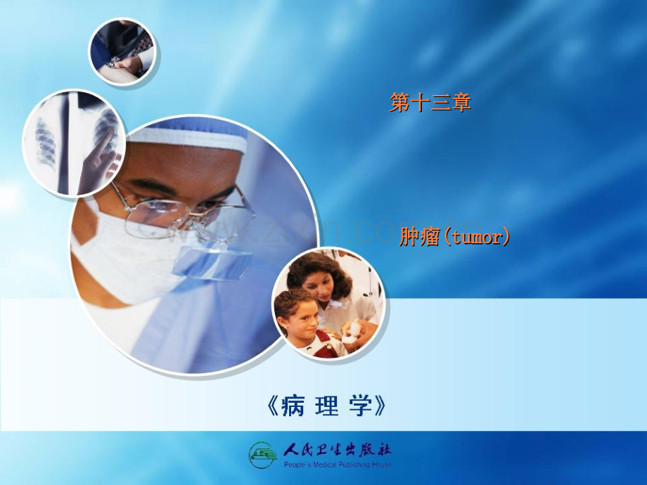 第13章--肿瘤ppt课件.ppt_第1页