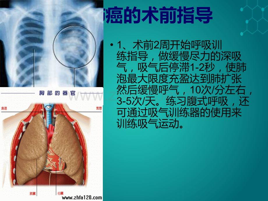 肺癌的相关护理ppt课件.ppt_第3页