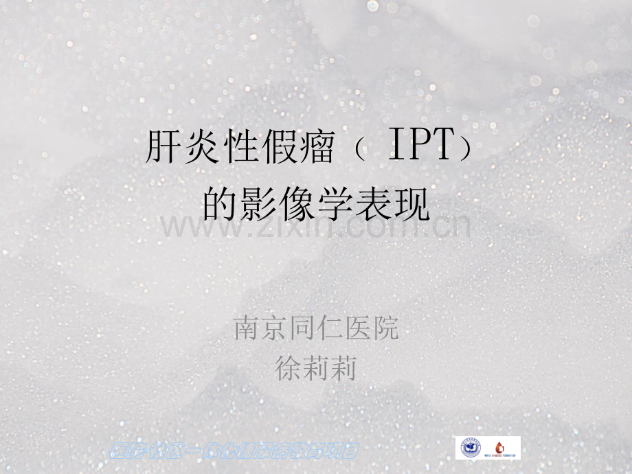肝脏炎性假瘤的影像学表现ppt课件.ppt_第1页
