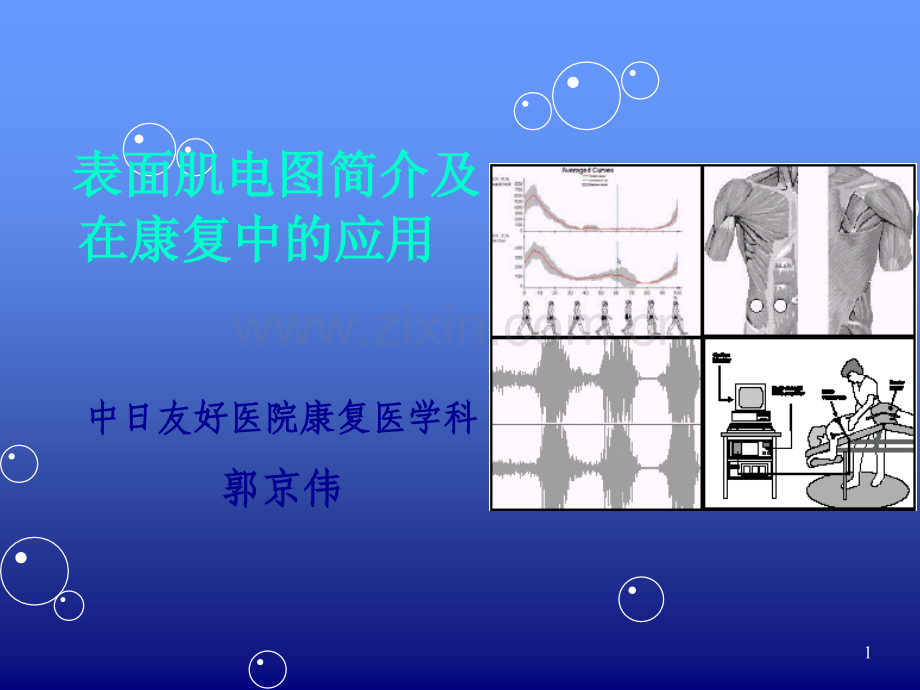 表面肌电图简介及应用(北中医版).ppt_第1页