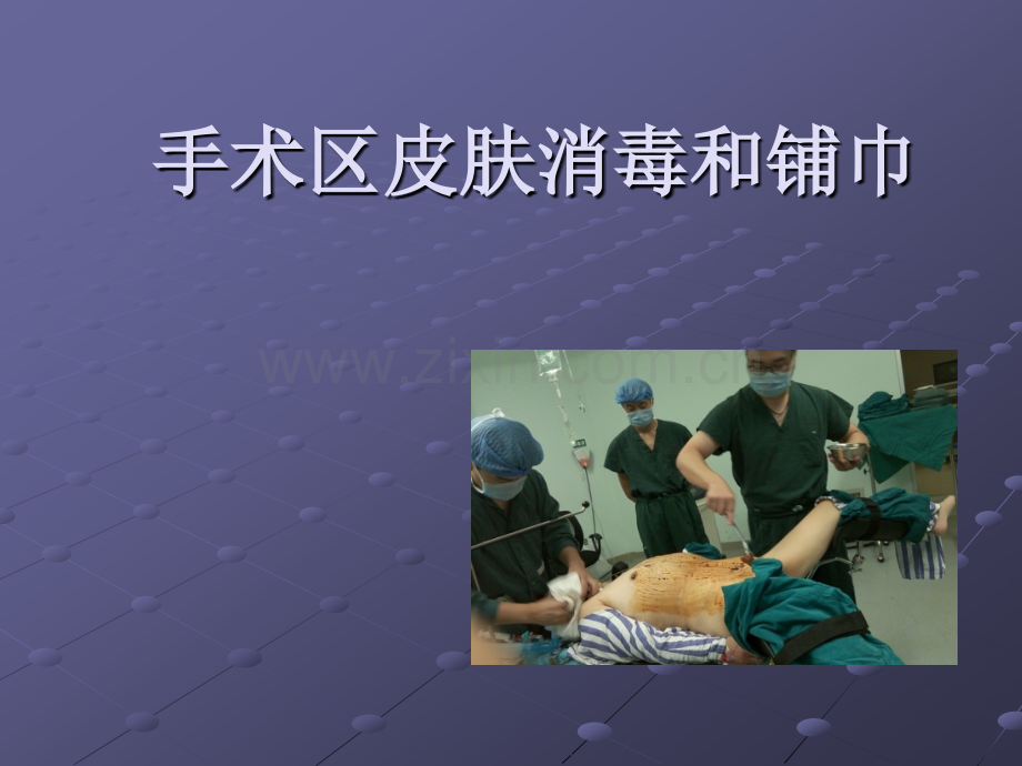 手术区皮肤的消毒和铺巾ppt课件.pptx_第1页