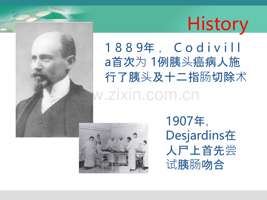 胰肠吻合方式PPT课件.ppt_第2页