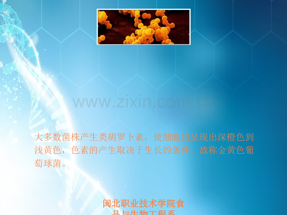 微生物-金黄色葡萄球菌.ppt_第2页