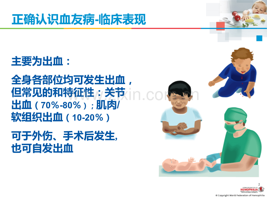 血友病治疗的注意事项PPT课件.ppt_第2页