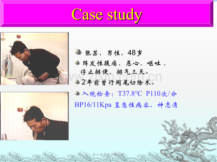 外科肠梗阻课件.ppt_第1页