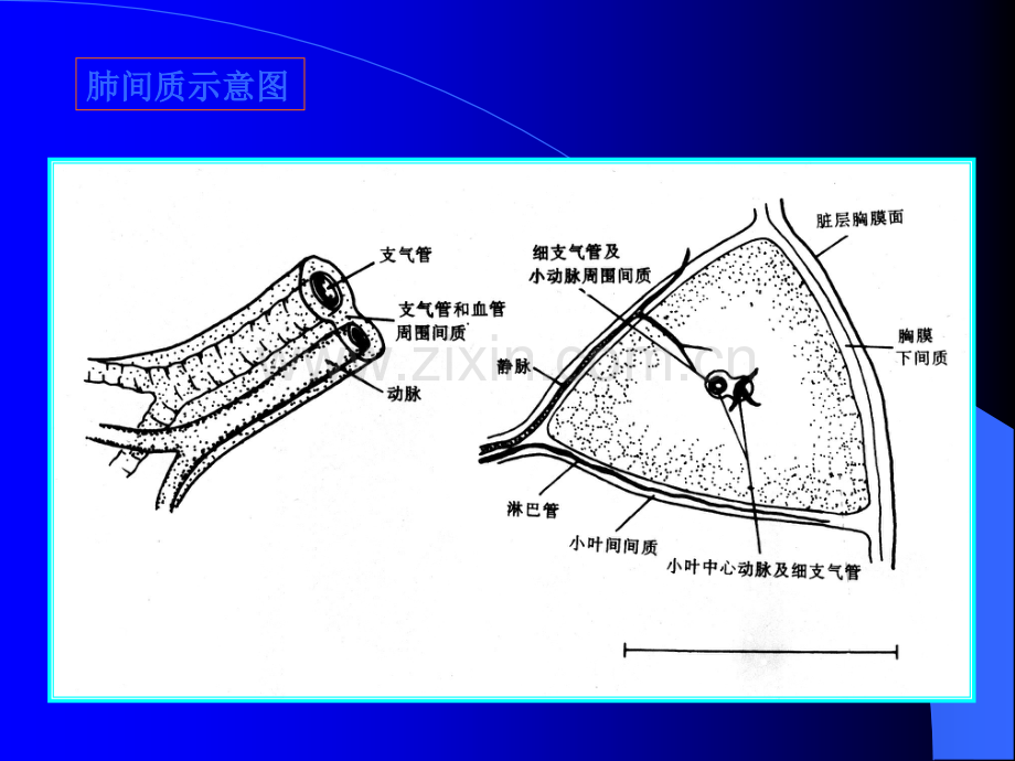 肺间质性病变-CT图片(1)ppt课件.ppt_第2页