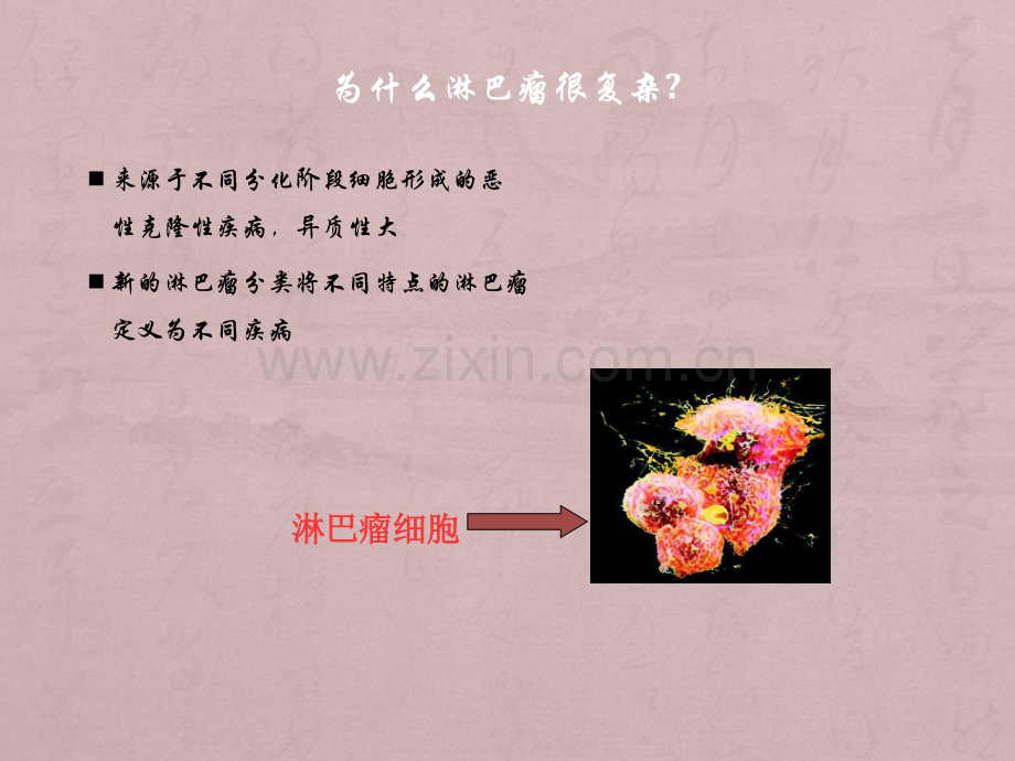 淋巴瘤分子诊断临床应用ppt课件.pptx_第2页