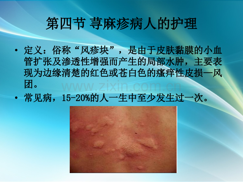 荨麻疹病人的护理.ppt_第1页