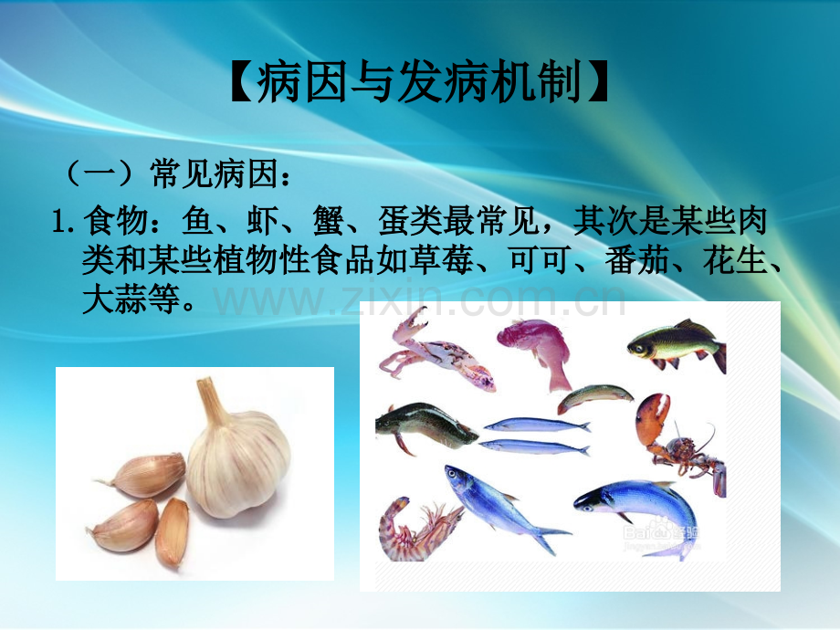 荨麻疹病人的护理.ppt_第2页