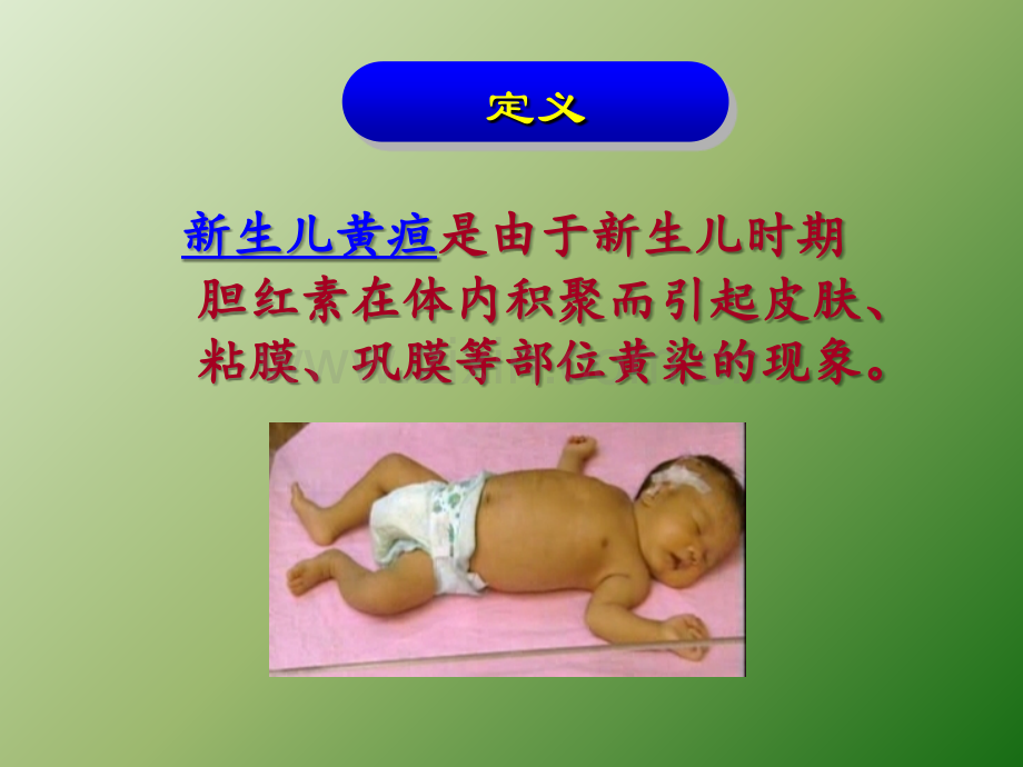新生儿黄疸的表现及护理.ppt_第2页