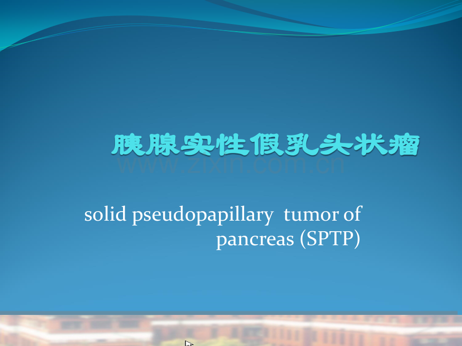 胰腺实性假乳头状瘤.pptx_第1页
