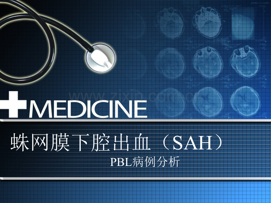 蛛网膜下腔出血BL教学ppt课件.pptx_第1页