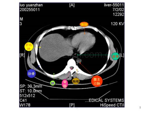 腹部CT-断层解剖结构.ppt