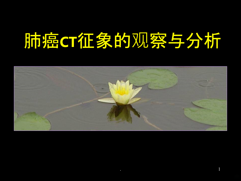 肺癌的CT征象PPT课件.ppt_第1页