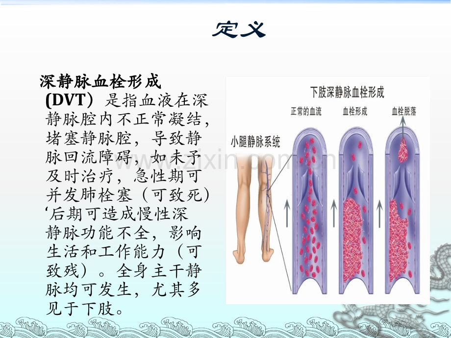 下肢深静脉血栓形.ppt_第2页
