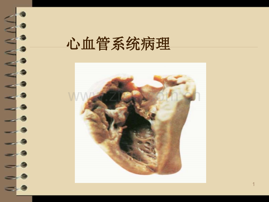 心血管系统病理-ppt课件.pptx_第1页