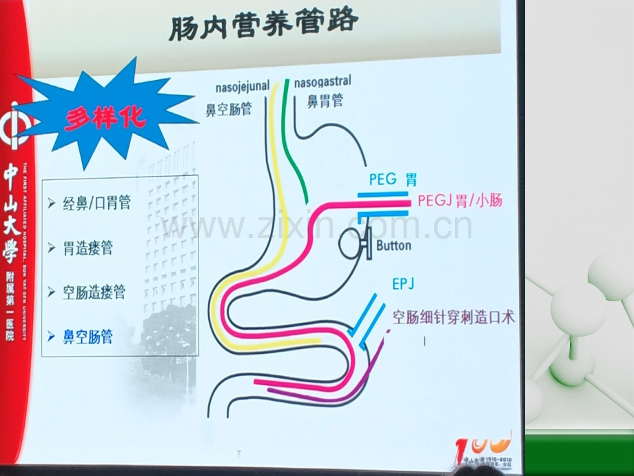 空肠营养管的护理ppt课件.pptx_第2页