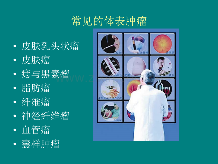 体表肿瘤.ppt_第2页