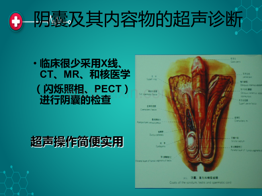 第十章--阴囊及其内容物的超声诊断ppt课件.ppt_第1页