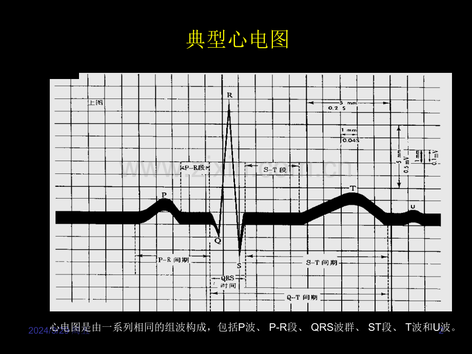 电机械耦联与心律失常.pptx_第2页