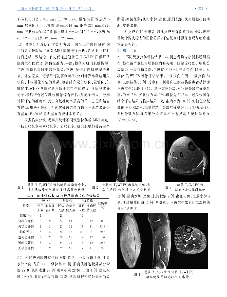 MRI在腓肠肌急性拉伤的分级及拉伤后修复评估中的作用.pdf_第2页
