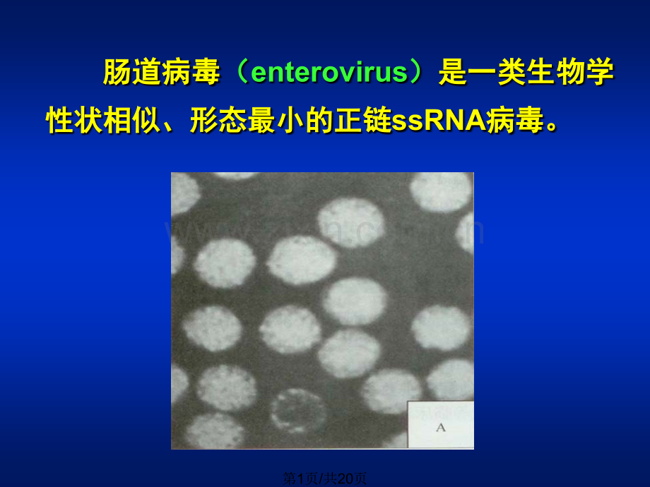 27肠道病毒.pptx_第1页