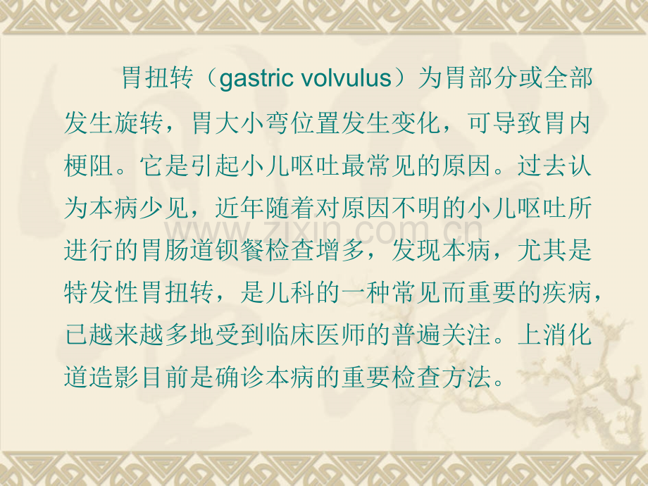 胃扭转的X线诊断与鉴别诊断ppt课件.ppt_第2页