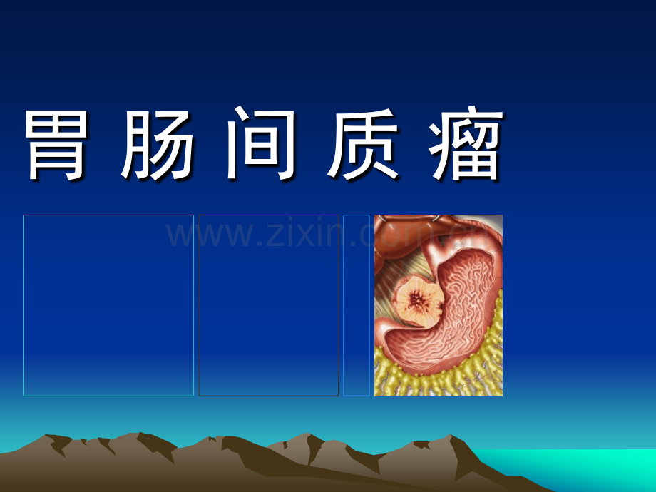 胃肠间质瘤(GIST).ppt_第1页