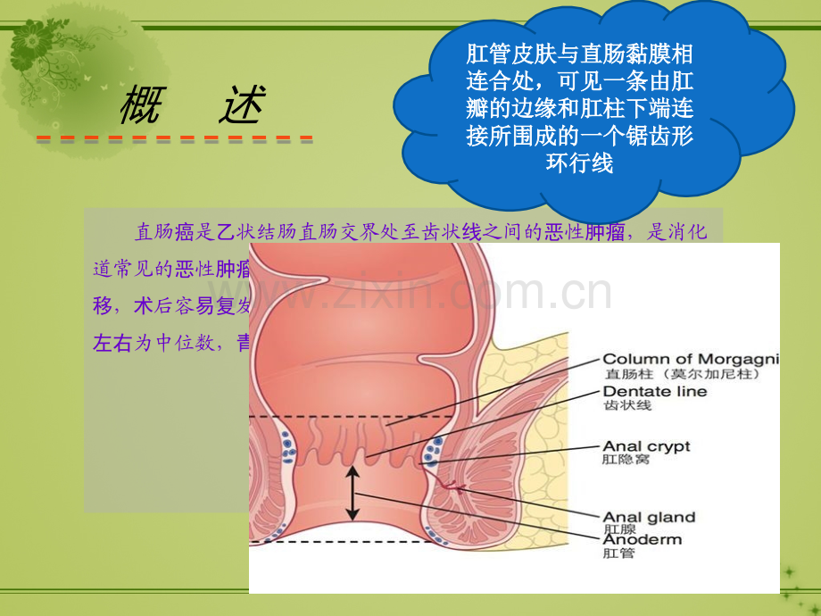 直肠癌的教学查房.pptx_第2页