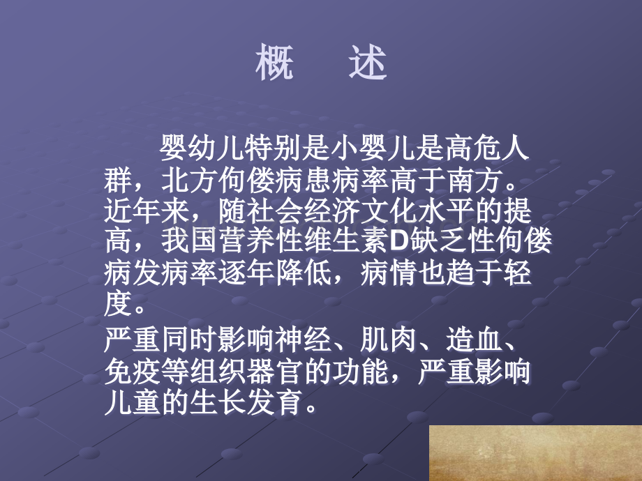 维生素D缺乏性佝偻病.ppt_第2页