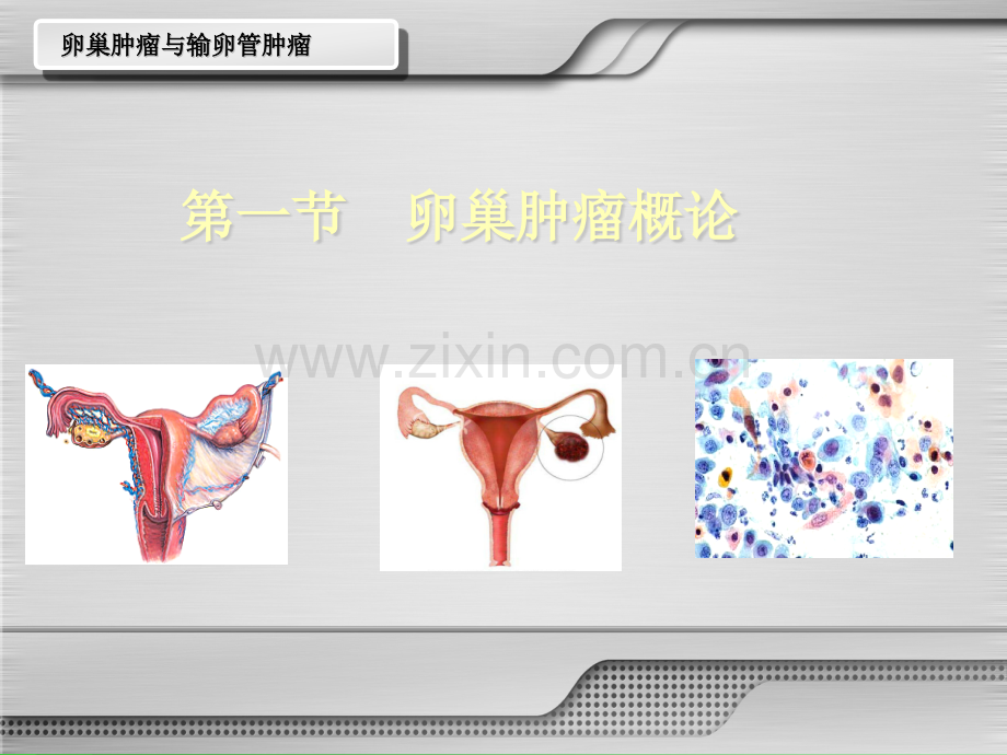 卵巢肿瘤与输卵管肿瘤ppt课件.pptx_第2页