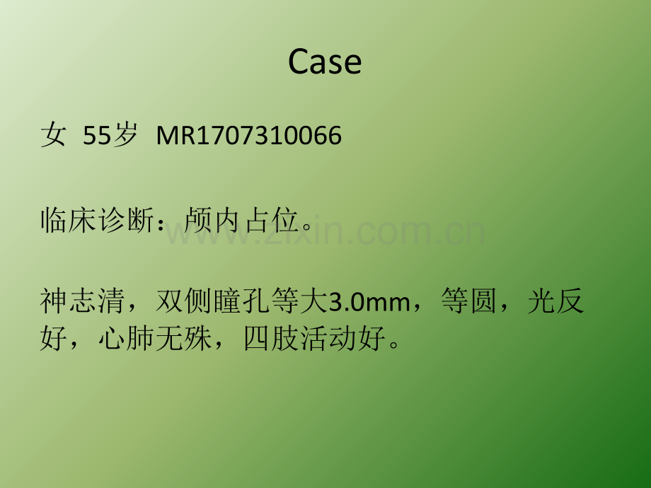 Galen静脉瘤影像ppt课件.pptx_第2页