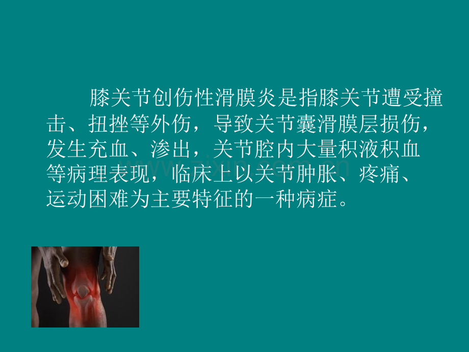膝关节创伤性滑膜炎PPT课件.ppt_第2页