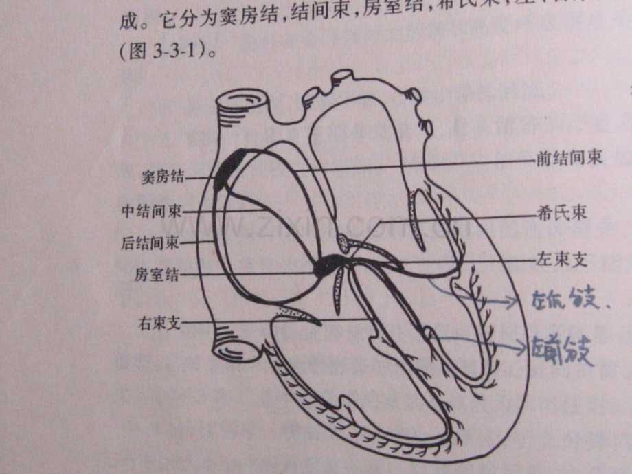常见心电图诊断.ppt_第2页