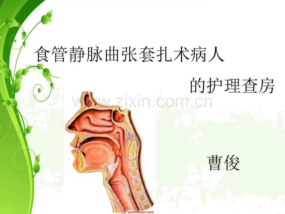 曹俊护理查房.pptx_第1页