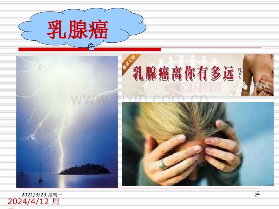 乳腺癌患者的护理查房.ppt_第2页