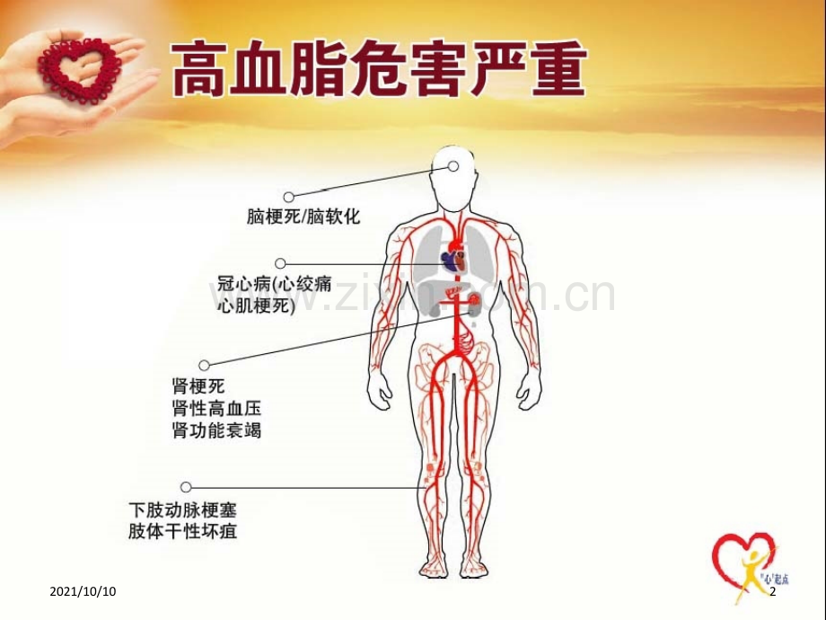 高血脂-危害.ppt_第2页