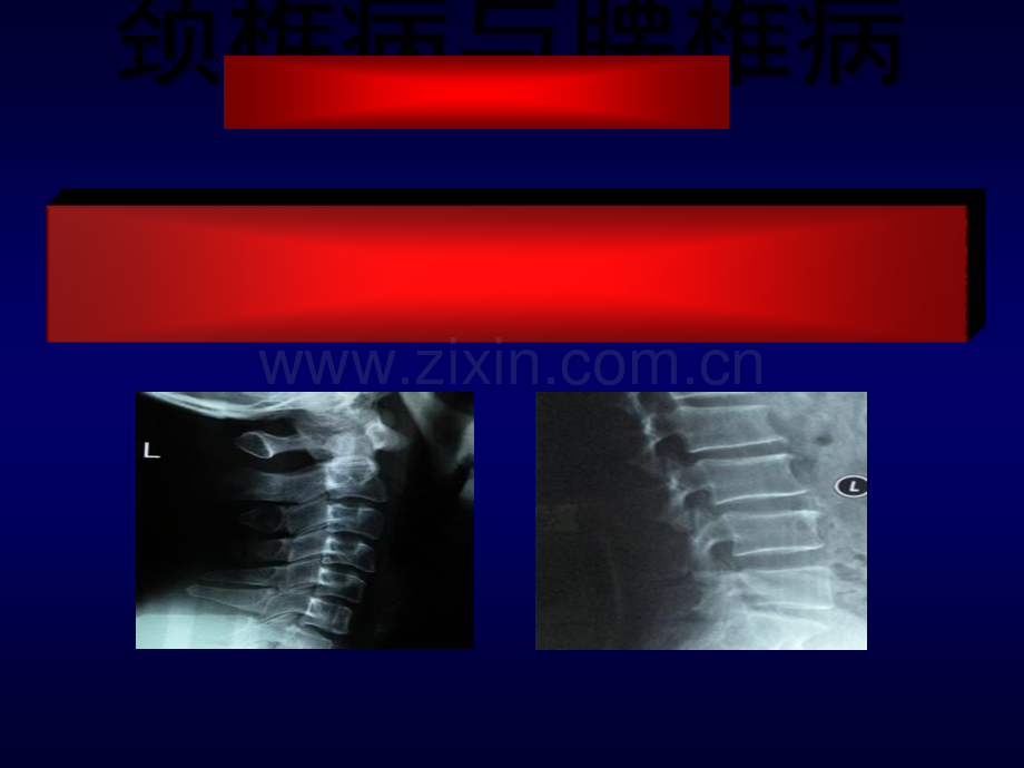 颈椎病与腰椎病.tmp.ppt_第1页