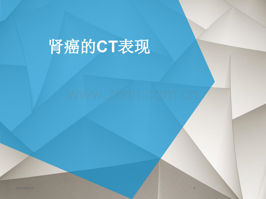 肾癌CT表现.ppt_第1页