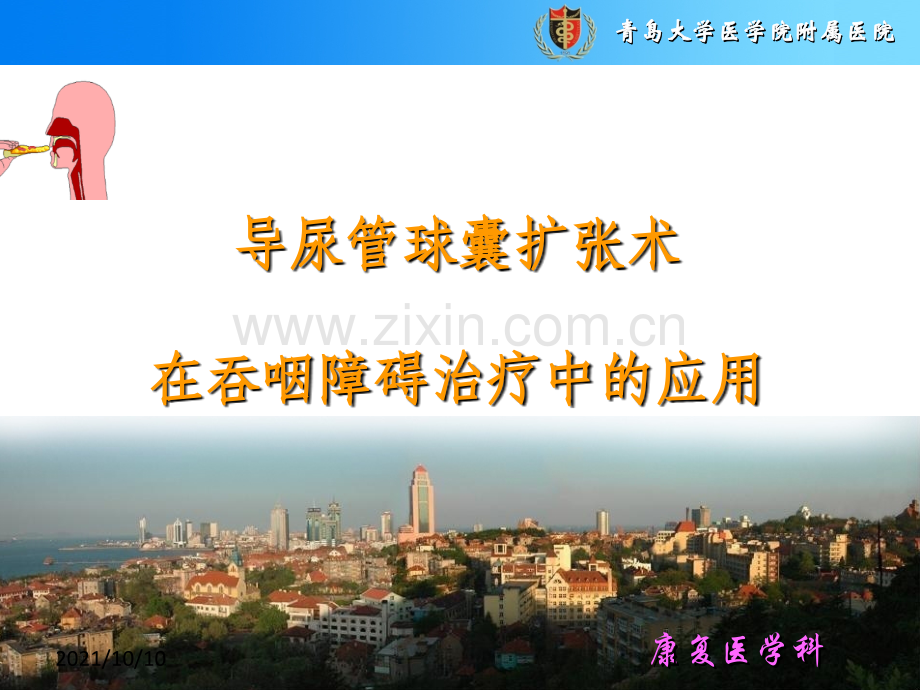 导尿管球囊扩张术在吞咽障碍治疗中应用.ppt_第1页