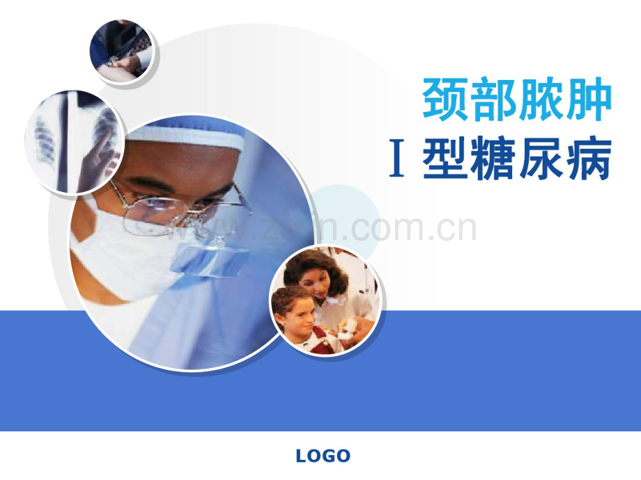 颈部脓肿.pdf_第1页
