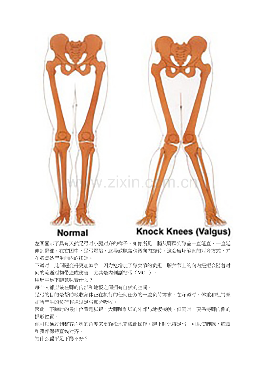 如何训练扁平足的客户进行深蹲训练.doc_第2页
