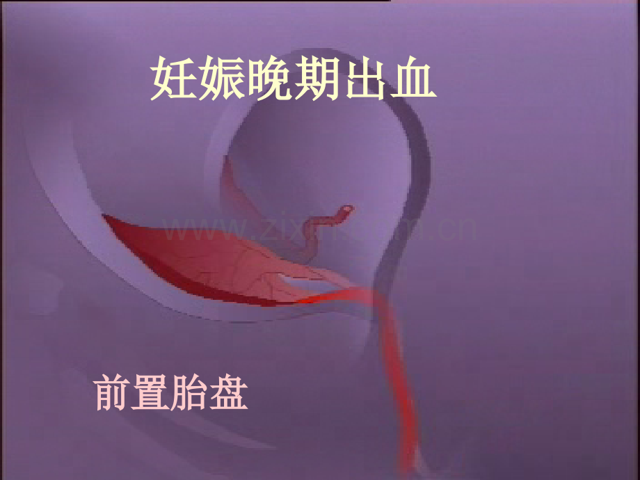 妊娠晚期出血性疾病.ppt_第1页