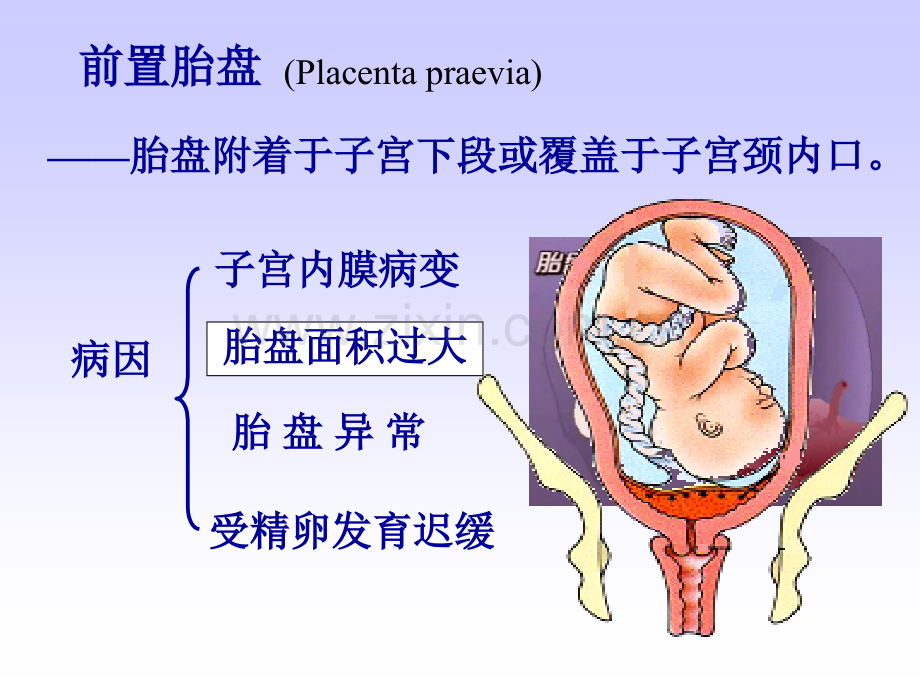 妊娠晚期出血性疾病.ppt_第2页