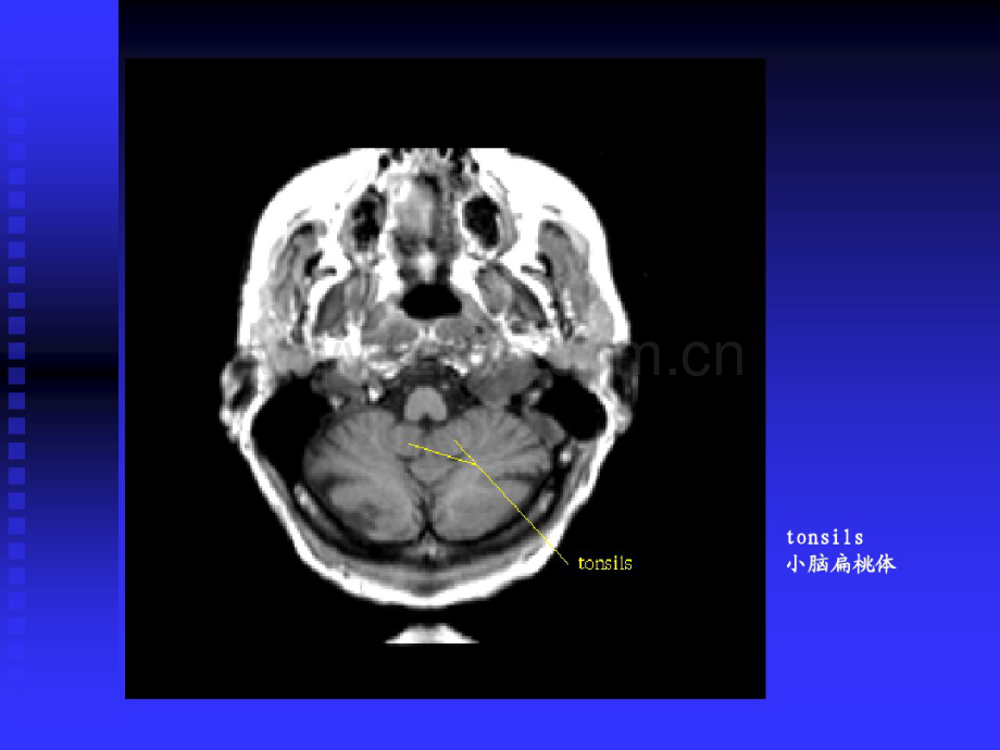 颅脑磁共振影像辨识(20190912180153).pdf_第2页