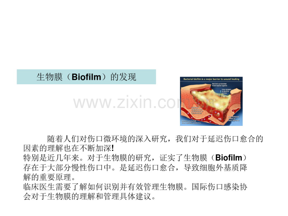 微动力负压普外科forDoctor.pdf_第2页